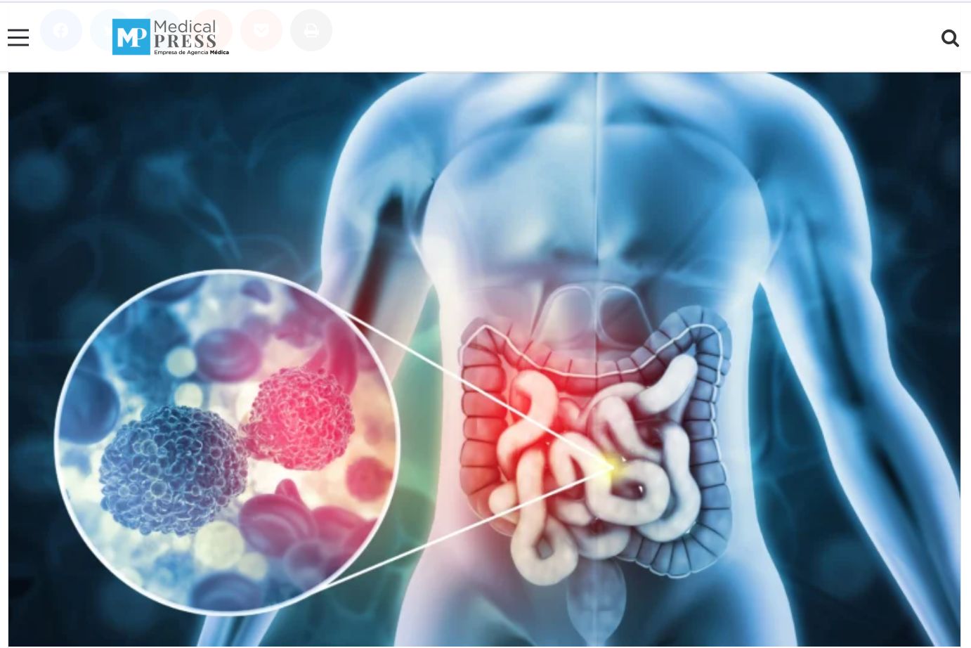 Día contra el Cáncer de Colon: se posiciona como el segundo cáncer más frecuente en Chile y refuerza la urgencia de fortalecer la detección temprana